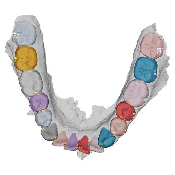 Intraoral scan of a full Dental arch