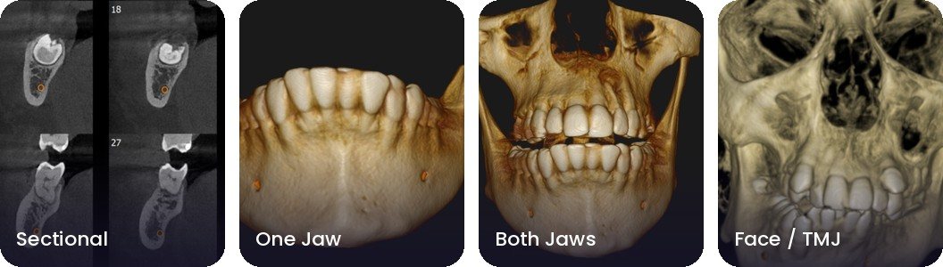 CBCT views stored in the Dentread archive: sectional, one jaw, both jaws, and face and TMJ